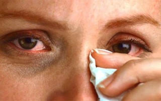 Слезотечение глаз: норма и патология