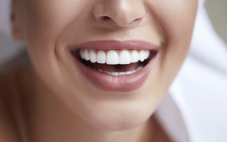 Возвращение улыбки с имплантацией зубов