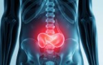 Как отличить цистит от других урологических проблем по симптомам: понятный и практичный гид