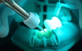 Удаление зуба в Москве: когда тянуть нельзя и как проходит процедура