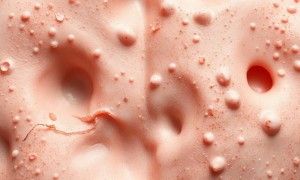 Цистит при дефиците цинка: как связаны иммунитет и слизистые