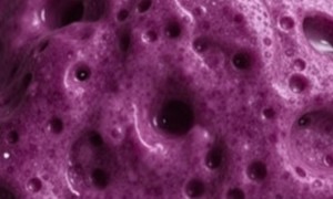 Цистит при лохиометре: что важно знать о связи двух разных, но опасно соседствующих проблем