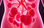 Цистит при иммунодефиците: почему болезнь ведет себя иначе и что важно не пропустить