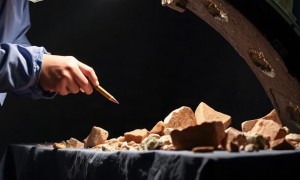 Цистолитотрипсия: как дробят камни в мочевом пузыре и что важно знать заранее