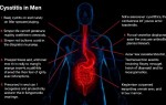 Цистит у мужчин: почему он бывает, как проявляется и что важно для точной диагностики