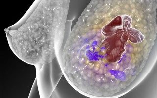 Секреты борьбы с раком молочной железы
