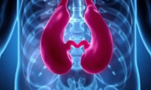 Цистит у пожилых людей: почему он выглядит по‑другому и как с ним справляться