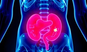 Лучевой цистит: осложнение после лечения онкологии