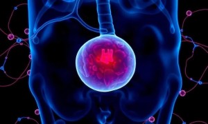 Цистит при дефиците селена: что известно и где проходит граница между фактами и домыслами