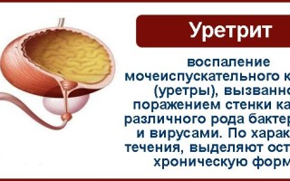 Ушаны летучие мыши: загадочные крылатые создания ночного мира