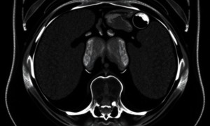 МРТ брюшной полости: зачем идти и чего ожидать от современного исследования