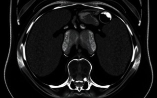 МРТ брюшной полости: зачем идти и чего ожидать от современного исследования