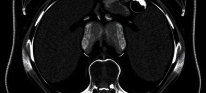 МРТ брюшной полости: зачем идти и чего ожидать от современного исследования