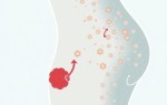 Профилактика цистита у женщин: как избежать неприятных симптомов и сохранить здоровье мочевого пузыря