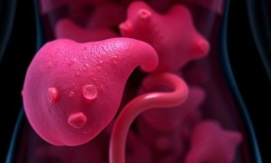 Цистит при терапии ингибиторами SGLT2: почему сахар в моче меняет правила игры