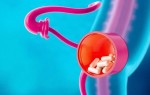 Влияние лекарств на риск цистита: какие препараты делают вас уязвимее и что с этим делать