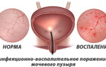 Как понять порок сердца у плода: что важно знать будущей маме