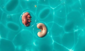Цистит от открытого водоёма: как купание может привести к инфекции