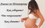 Анализ мочи по Нечипоренко во время беременности
