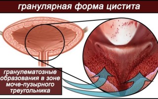 Квакша: Загадочные жители водоемов и лесов