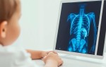Рентгенография в педиатрии: особенности и рекомендации по безопасности
