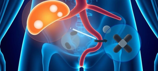 Холиноблокаторы при цистите: как они работают и зачем нужны