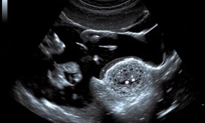 УЗИ матки и яичников: понятная инструкция для тех, кто собирается на обследование