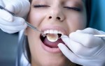 Когда нужно срочно идти к стоматологу?