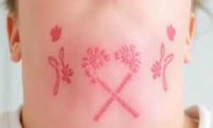 Цистит от бытовых аллергенов: редкий триггер, о котором легко не подумать