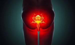 Цистит после вагинальных спринцеваний: зачем это делают и чем это может закончиться