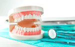 Что входит в подготовку для протезирования зубов