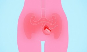 Гигиена при цистите: простые правила, которые действительно помогают быстрее выздороветь