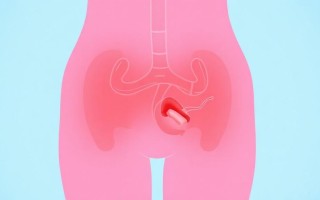 Гигиена при цистите: простые правила, которые действительно помогают быстрее выздороветь