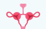 Цистит и гормональный фон: влияние гормонов на женское здоровье