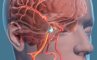 Операции на сосудах головного мозга: разновидности и их особенности