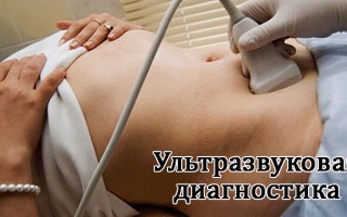 Что делать при сильном потоотделении под мышками: практическое руководство