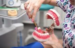 Особенности чистки зубов в стоматологии