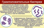 Гипергомоцистеинемия: что это такое у женщин и как распознать симптомы