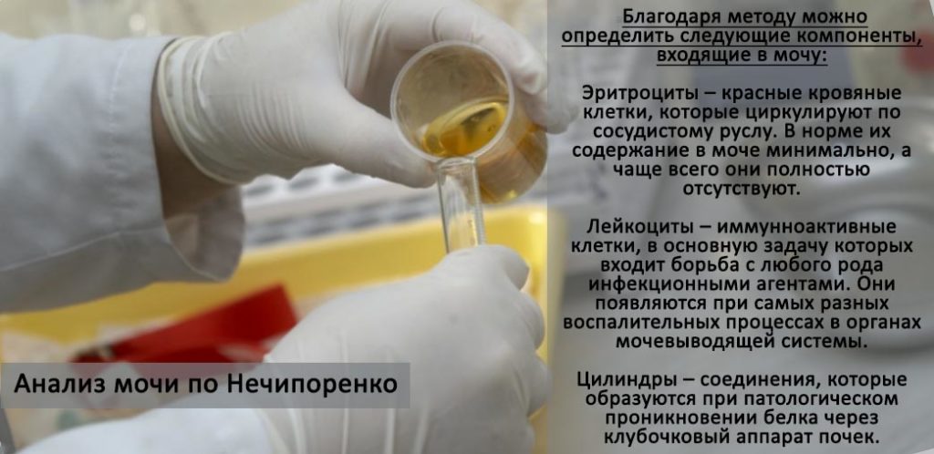 Анализ мочи по Нечипоренко, что это такое, алгоритм проведения, для ...