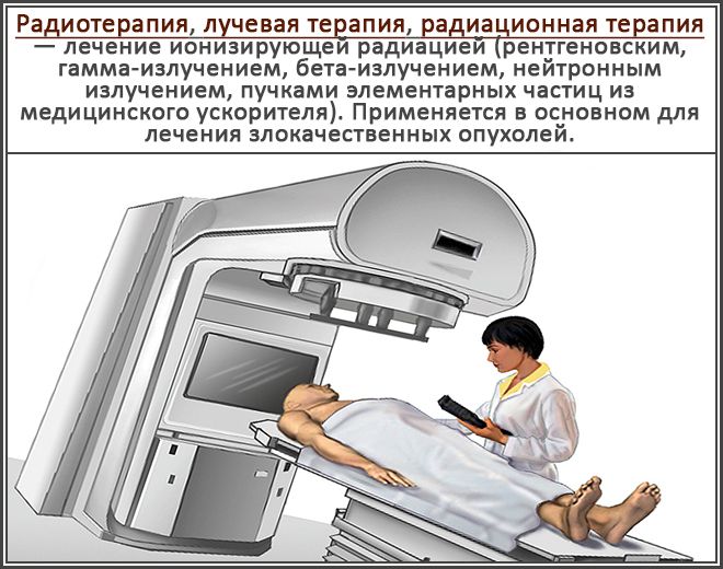 Радиотерапия