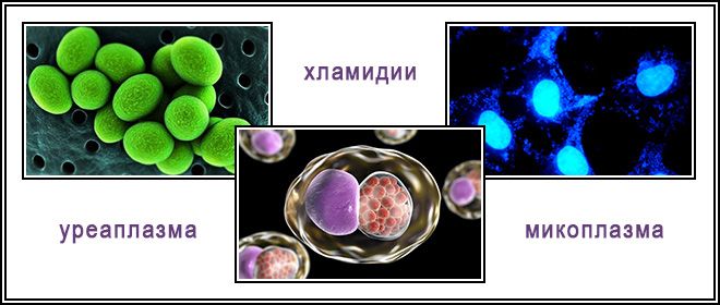 Chlamydia trachomatis mycoplasma genitalium. Хламидии микоплазма уреаплазма. Микоплазмоз, уреаплазмоз, хламидиоз.