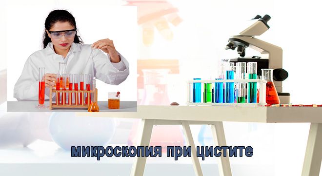 микроскопия при цистите