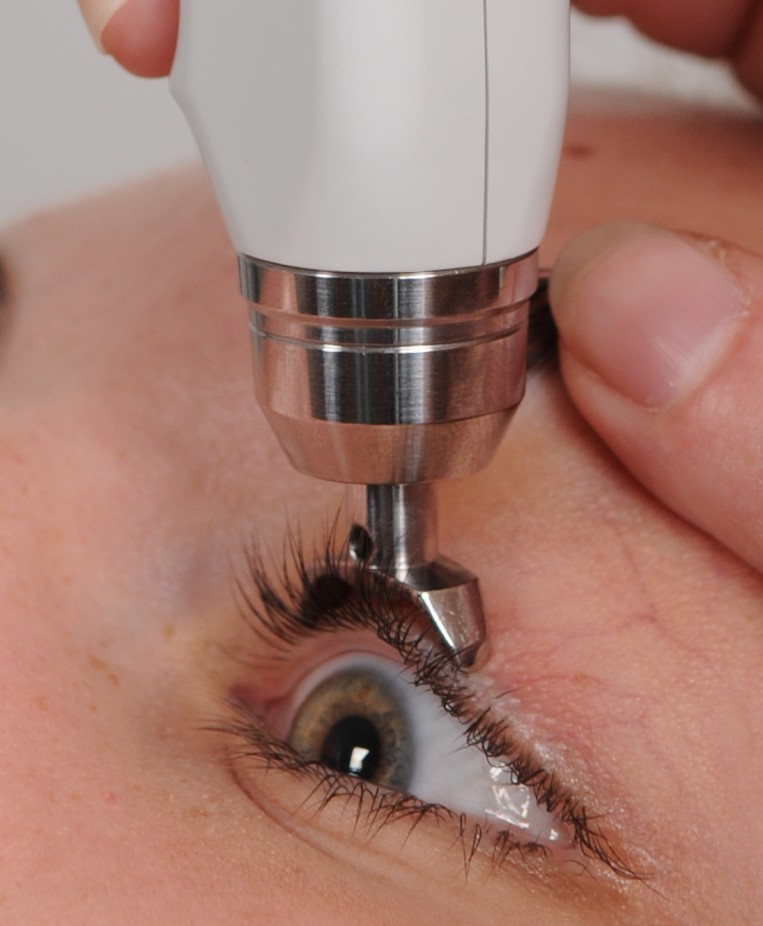Глазное давление: нормы и причины изменения