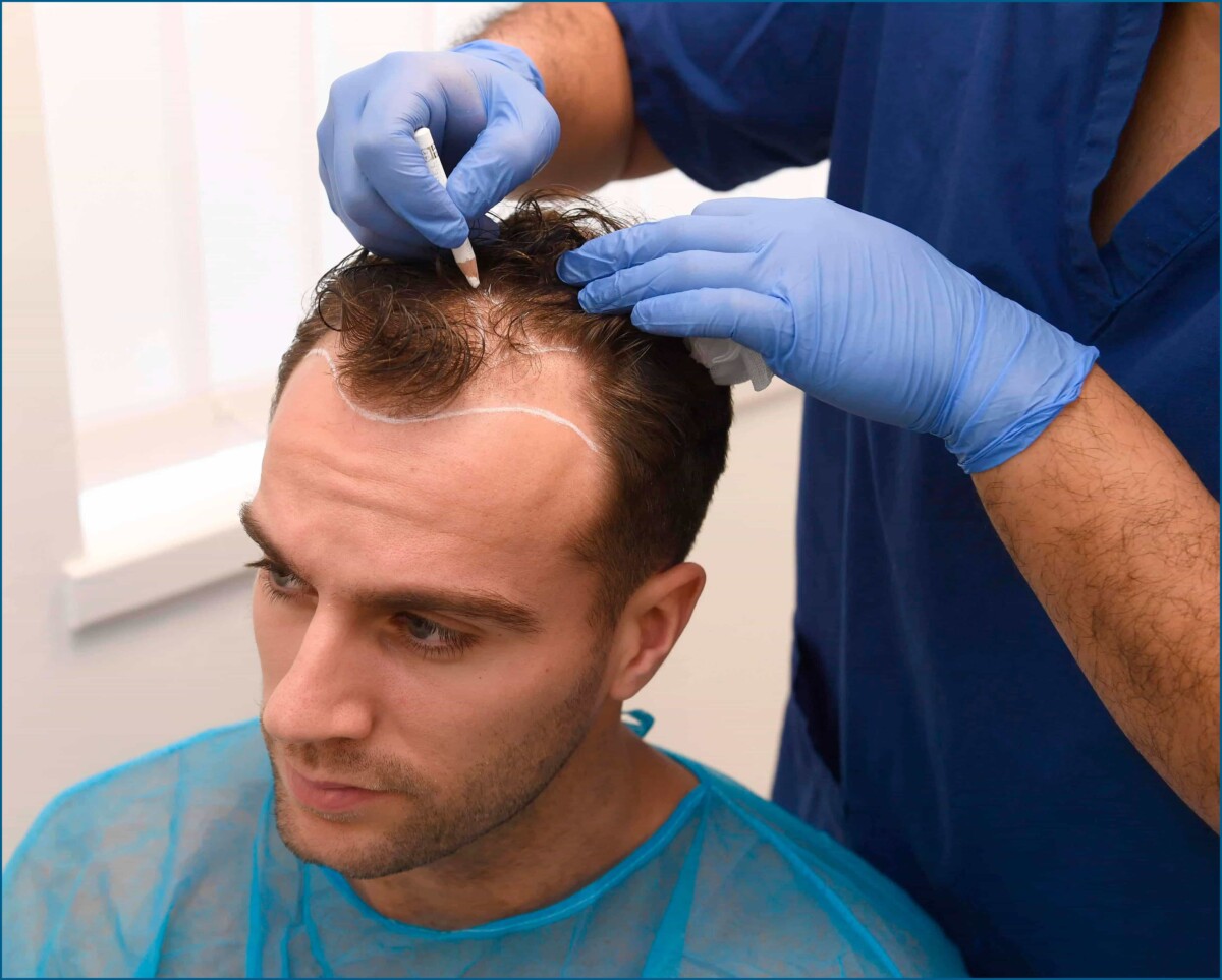 Какие услуги оказывают клиники пересадки волос?