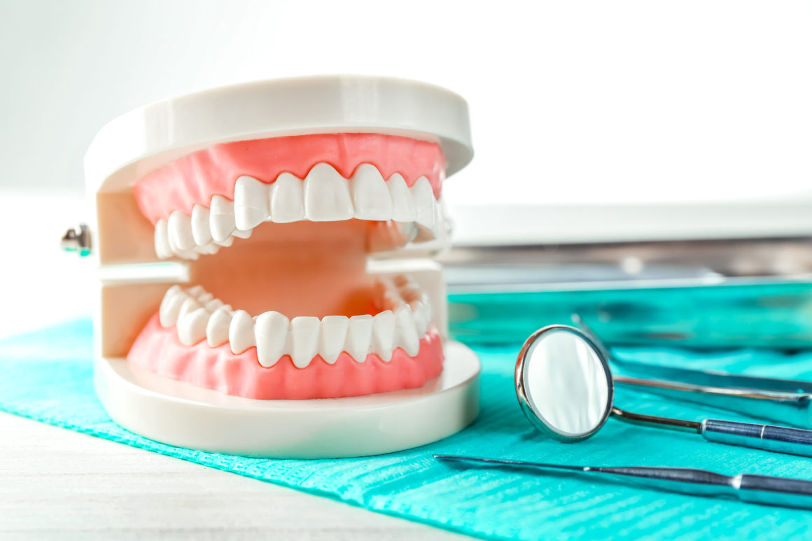 Что входит в подготовку для протезирования зубов