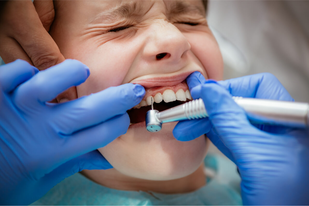 Лечение зубов в стоматологии: все, что вам нужно знать